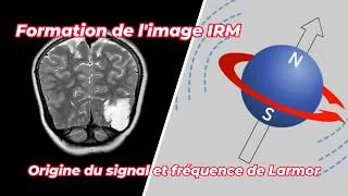 Miniature : IRM: Origine du signal et fréquence de Larmor | Précession des protons expliquée simplement