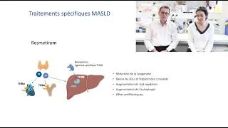 Miniature : La MASLD, MOOC FHU-GO MASH – Quelle stratégie thérapeutique envisager ? (5/5)