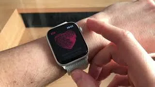 Miniature : Comment mesurer un électrocardiogramme avec l’Apple Watch (ECG) - En France aussi !