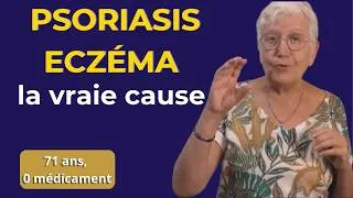 Miniature : Psoriasis, peau sèche, eczéma : ce que l'alimentation cache !