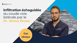 Miniature : Infiltration échoguidée du coude par voie latérale | iSonicSchool
