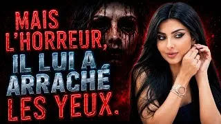 Miniature : Il Lui a arr*ché les yeux 😱‼️