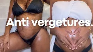 Miniature : MON GOMMAGE NATUREL AU CAFÉ ANTI VERGETURES ET CELLULITES POUR GROSSESSE !🤰🏽