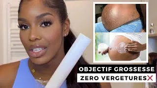 Miniature : PEAU SOUPLE ET SANS VERGETURES PENDANT LA GROSSESSE: ASTUCES MAISON ET PRODUITS RECOMMANDÉS !