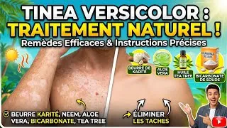 Miniature : Traitement Naturel Efficace (7 Remèdes + Instructions Précises)