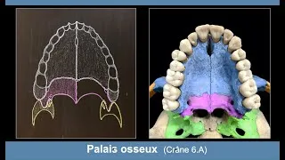 Miniature : Anatomie du palais osseux (Ostéologie du crâne 6.A)