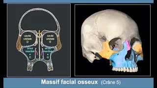 Miniature : Anatomie du massif facial osseux (Ostéologie du crâne 5)