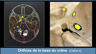 Miniature : Anatomie des orifices de la base du crâne (Ostéologie du crâne 4)