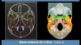 Miniature : Anatomie de la base externe du crâne (Ostéologie du crâne 3)