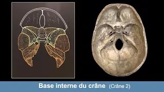 Miniature : Anatomie de la base interne du crâne (Ostéologie du crâne 2)