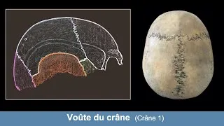 Miniature : Anatomie de la voûte du crâne (Ostéologie du crâne 1)