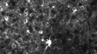 Miniature : CaImAn Calcium Imaging Analysis  3/4
