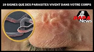 Miniature : 19 signes que des parasites vivent dans votre corps
