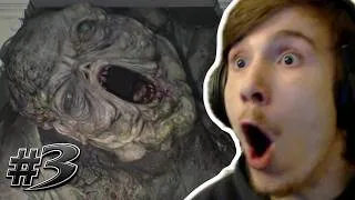Miniature : C'EST QUOI CE TRUC ?! (Resident Evil Requiem) #3