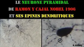 Miniature : Le neurone pyramidal de Ramon y Cajal et ses épines dendritiques, Hervé Kempf, Lycée de l'Elorn