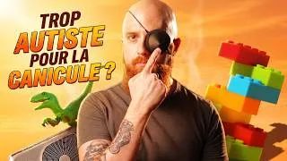 Miniature : Il m'est arrivé quoi à l’œil ?