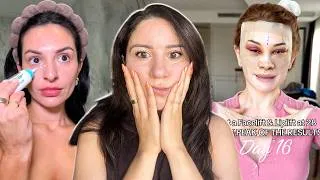 Miniature : IL FAUT qu'on PARLE de la CHIRURGIE ESTHETIQUE chez les jeunes (GENZ,  MILLENNIALS)