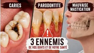Miniature : Hors Série - Caries, parodontite, mal-occlusions : nos habitudes de vies sont nos propres maux.