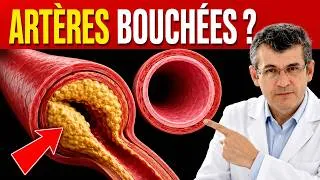 Miniature : Artères Bouchées : 7 Actions Qui Peuvent Réduire Votre Risque Cardiovasculaire