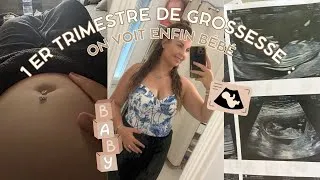 Miniature : VLOG GROSSESSE : Épisode 2 - Le 1er trimestre | Entre excitation et fatigue ! 🌸