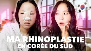 Miniature : J’AI REFAIS MON NEZ EN CORÉE DU SUD 🇰🇷 (prix, douleur... je vous dis tout)