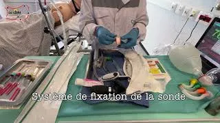 Miniature : Intubation oro-trachéale, Laryngoscopie Directe avec mandrin d'Eschmann