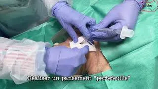 Miniature : Cricothyroïdotomie - Technique SMS