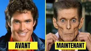 Miniature : 25 célébrités qui ont terriblement vieilli – vous ne les reconnaîtrez pas en 2025..