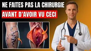Miniature : Varices : le rituel du soir de 5 minutes que peu de médecins recommandent