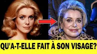 Miniature : Avant et après : comment la CHIRURGIE ESTHÉTIQUE a défiguré le visage de 11 CÉLÉBRITÉS FRANÇAISES?