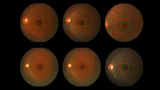 Miniature : Intelligence Artificielle, réseau de neurones,  détection d'anomalie