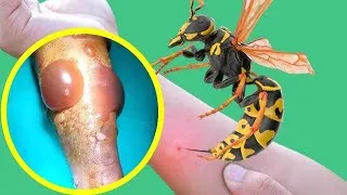 Miniature : Les Morsures Les Plus Dangereuses Du Monde Animal☠