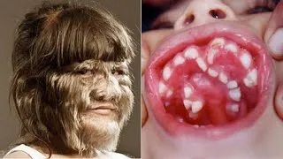 Miniature : 9 Mutations Incroyables Que Vous Ne Croirez Pas Exister🧬🧪