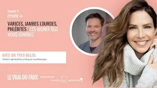 Miniature : Varices, jambes lourdes, phlébite : les signes que vous ignorez