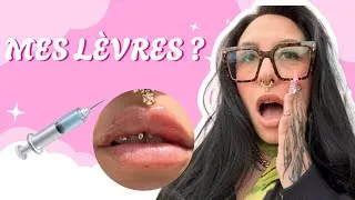 Miniature : JE REFAIS MES LÈVRES… puis colo + stream avec vous 💉