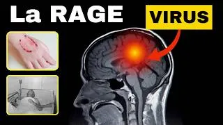 Miniature : La rage : un des virus les plus dangereux 