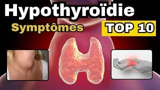 Miniature : 10 signes d'HYPOTHYROÏDIE à connaître absolument
