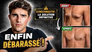 Miniature : LA GYNÉCOMASTIE - 3 ERREURS à éviter pour réussir son opération !
