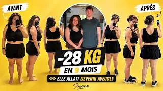Miniature : Aveugle a cause de son poids ?! elle perd 28 kilos