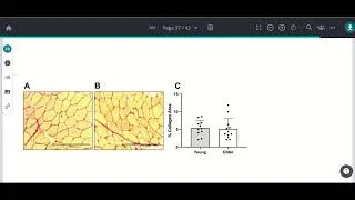 Miniature : Timing et conséquence du catabolisme des fascias musculaires suite à une séance de muscu? (part 1/2)