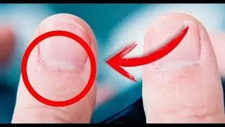 Miniature : Savez-vous ce que signifie la demi-lune à la racine de vos ongles ?...