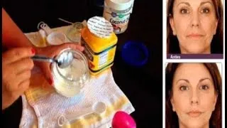 Miniature : Cette femme a utilisé cette incroyable crème faite maison pendant une semaine et...