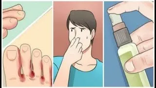Miniature : Vous ne serez plus jamais gêné : avec ces astuces, le problème des pieds puants sera du passé !
