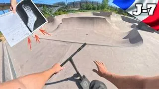 Miniature : MA PIRE BLESSURE EN TROTTINETTE FREESTYLE — Retour  7 jours avant les championnats de France !!