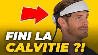 Miniature : ✅ Diminuer la CHUTE DE CHEVEUX et CALVITIE et améliorer la POUSSE avec le casque GROWBAND PRO 🚀
