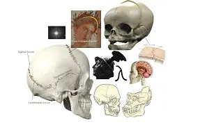 Miniature : Anatomie du crane : sutures , points craniométriques et fontanelles