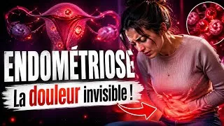 Miniature : Endométriose : la douleur invisible 