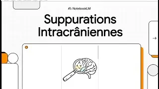 Miniature : Suppurations Intracrâniennes