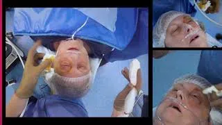 Miniature : Péribulbaire échoguidée Dr Lucie Beylacq / ultrasound guided peribulbar block Cas clinique  2