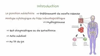 Miniature : Ponction sternale - Myélogramme: Aperçu Fascinant en 1 Minute! 💉